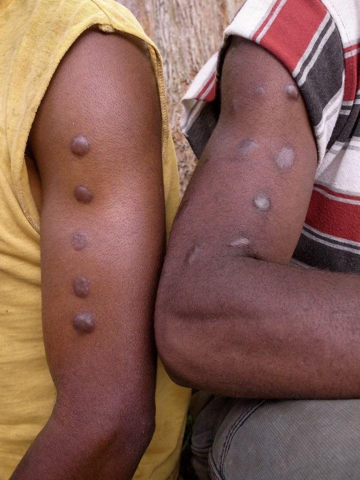 第16話 ニューギニア島【前篇】