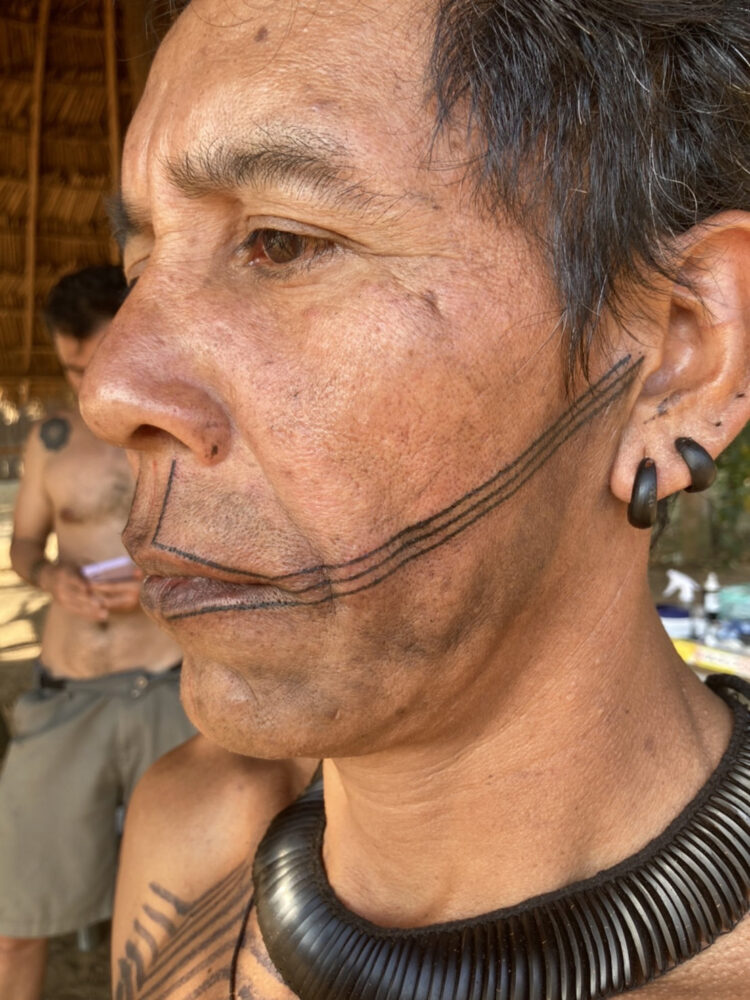 第1話 アマゾン【前篇】